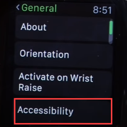 Select Accessibility